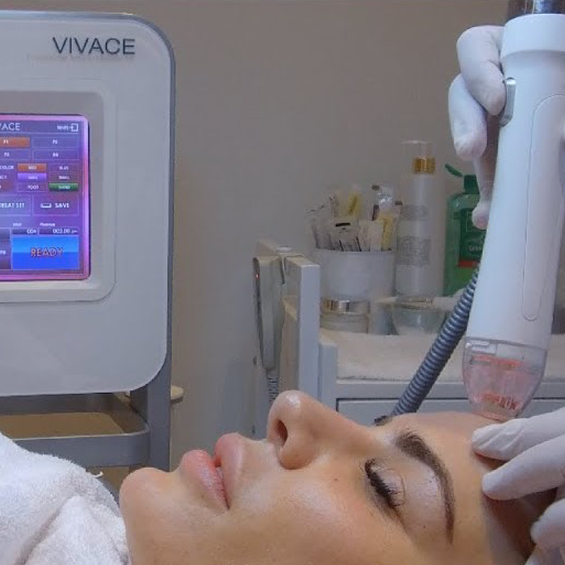 VIVACE RF Микронидлинг